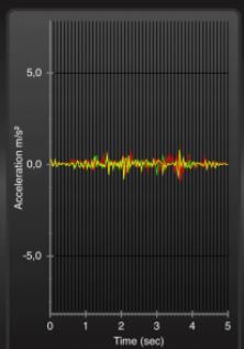 Messung Lageänderung Matratze